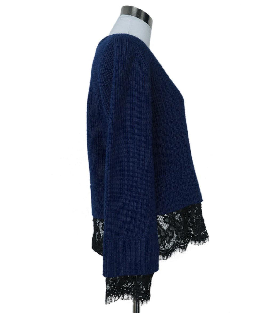 Moschino Love Blue & Black Lace Cardigan 1